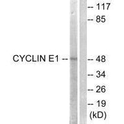 Western blot analysis of extracts from HeLa cells, treated with Paclitasel (1uM, 60mins), using Cyclin E1 (Ab-395) antibody.