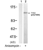 Western blot analysis of extracts from HT29 cells untreated(lane 1) or treated with Anisomycin(lane 2) using TYK2(Phospho-Tyr1054) Antibody.