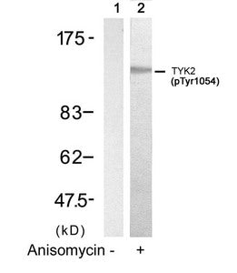 Western blot analysis of extracts from HT29 cells untreated(lane 1) or treated with Anisomycin(lane 2) using TYK2(Phospho-Tyr1054) Antibody.