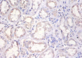 Immunohistochemistry of paraffin-embedded human kidney tissue using CSB-PA15429A0Rb at dilution of 1:100
