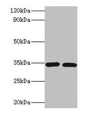 Western blot All lanes: CASP7 antibody at 2µg/ml Lane 1: A549 whole cell lysate Lane 2: HGC-27 whole cell lysate Secondary Goat polyclonal to rabbit IgG at 1/10000 dilution Predicted band size: 35, 29, 38, 32 kDa Observed band size: 35 kDa