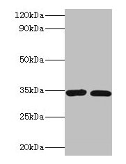 Western blot All lanes: CASP7 antibody at 2µg/ml Lane 1: A549 whole cell lysate Lane 2: HGC-27 whole cell lysate Secondary Goat polyclonal to rabbit IgG at 1/10000 dilution Predicted band size: 35, 29, 38, 32 kDa Observed band size: 35 kDa