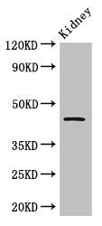 Western Blot Positive WB detected in: Mouse kidney tissue All lanes: Tp53 antibody at 2.5µg/ml Secondary Goat polyclonal to rabbit IgG at 1/50000 dilution Predicted band size: 44 kDa Observed band size: 44 kDa