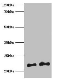 Western blot All lanes: Hras antibody at 2µg/ml Lane 1: 293T whole cell lysate Lane 2: Mouse brain tissue Secondary Goat polyclonal to rabbit IgG at 1/10000 dilution Predicted band size: 22 kDa Observed band size: 22 kDa