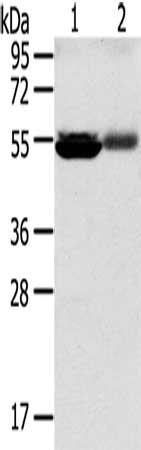 Gel: 8%SDS-PAGE, Lysate: 60 ug, Lane 1-2: Human kidney pericarcinous tissue, Human kidney cancer tissue, Primary antibody: CSB-PA155969(SLC17A1 Antibody) at dilution 1/200, Secondary antibody: Goat anti rabbit IgG at 1/8000 dilution, Exposure time...