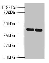 Western blot All lanes: Vasopressin V1b receptor antibody at 2ug/ml Lane 1: EC109 whole cell lysate Lane 2: 293T whole cell lysate Secondary Goat polyclonal to rabbit IgG at 1/10000 dilution Predicted band size: 47 kDa Observed band size: 47 kDa