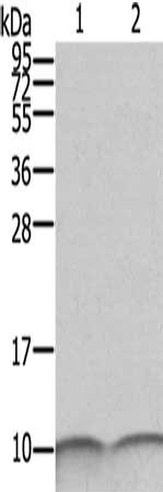Gel: 12%SDS-PAGE, Lysate: 40 ug, Lane 1-2: SKOV3 cells, A431 cells, Primary antibody: CSB-PA156572(S100A6 Antibody) at dilution 1/550, Secondary antibody: Goat anti rabbit IgG at 1/8000 dilution, Exposure time: 1 seconds