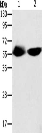 Gel: 10%SDS-PAGE, Lysate: 40 ug, Lane 1-2: Human fetal muscle tissue, Lncap cells, Primary antibody: CSB-PA156616(TEKT3 Antibody) at dilution 1/550, Secondary antibody: Goat anti rabbit IgG at 1/8000 dilution, Exposure time: 30 minutes