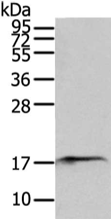 Gel: 12%SDS-PAGE, Lysate: 80 ug, Lane: Mouse bladder tissue, Primary antibody: CSB-PA156802(SNX12 Antibody) at dilution 1/200 dilution, Secondary antibody: Goat anti rabbit IgG at 1/8000 dilution, Exposure time: 2 minutes