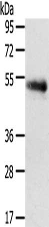 Gel: 8%SDS-PAGE, Lysate: 40 ug, Lane: 823 cells, Primary antibody: CSB-PA157177(SLC7A5 Antibody) at dilution 1/250, Secondary antibody: Goat anti rabbit IgG at 1/8000 dilution, Exposure time: 2 minutes
