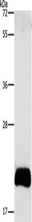 Gel: 12%SDS-PAGE, Lysate: 40 ug, Lane: PC3 cells, Primary antibody: CSB-PA157457(APOBEC3C Antibody) at dilution 1/420, Secondary antibody: Goat anti rabbit IgG at 1/8000 dilution, Exposure time: 15 seconds