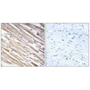 Immunohistochemistry analysis of paraffin-embedded human heart tissue using RPL3L antibody.