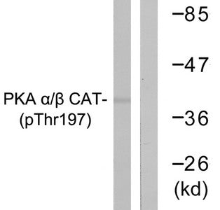 Western blot analysis of extracts from mouse brain cells using PKA α/β CAT (Phospho-Thr197) Antibody.The lane on the right is treated with the antigen-specific peptide.