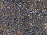 The image on the left is immunohistochemistry of paraffin-embedded Human tonsil tissue using CSB-PA157805(IL17D Antibody) at dilution 1/50, on the right is treated with synthetic peptide. (Original magnification: ×200)