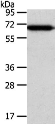 Gel: 8%SDS-PAGE, Lysate: 40 ug, Lane: Hepg2 cell, Primary antibody: CSB-PA157844(USP39 Antibody) at dilution 1/400 dilution, Secondary antibody: Goat anti rabbit IgG at 1/8000 dilution, Exposure time: 5 seconds