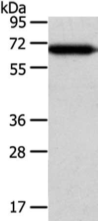 Gel: 8%SDS-PAGE, Lysate: 40 ug, Lane: Hepg2 cell, Primary antibody: CSB-PA157844(USP39 Antibody) at dilution 1/400 dilution, Secondary antibody: Goat anti rabbit IgG at 1/8000 dilution, Exposure time: 5 seconds