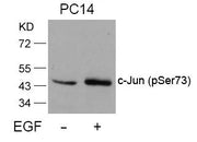 Western blot analysis of extracts from PC14 cells untreated or treated with EGF using c-Jun(Phospho-Ser73) Antibody.