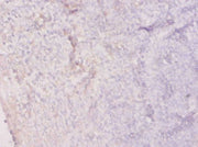 Immunohistochemistry of paraffin-embedded human tonsil tissue using CSB-PA15827A0Rb at dilution of 1:20