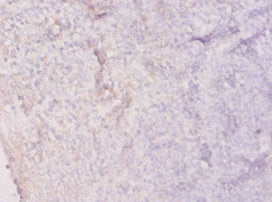 Immunohistochemistry of paraffin-embedded human tonsil tissue using CSB-PA15827A0Rb at dilution of 1:20