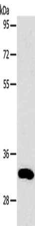 Gel: 12%SDS-PAGE, Lysate: 40 ug, Lane: Huvec cells, Primary antibody: CSB-PA158394(TIMP3 Antibody) at dilution 1/300, Secondary antibody: Goat anti rabbit IgG at 1/8000 dilution, Exposure time: 10 seconds