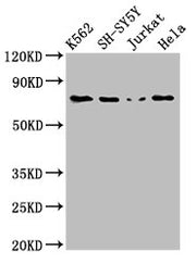 Western Blot Positive WB detected in: K562 whole cell lysate, SH-SY5Y whole cell lysate, Jurkat whole cell lysate, Hela whole cell lysate All lanes: PRKCB antibody at 3ug/ml Secondary Goat polyclonal to rabbit IgG at 1/50000 dilution Predicted ban...