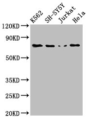 Western Blot Positive WB detected in: K562 whole cell lysate, SH-SY5Y whole cell lysate, Jurkat whole cell lysate, Hela whole cell lysate All lanes: PRKCB antibody at 3ug/ml Secondary Goat polyclonal to rabbit IgG at 1/50000 dilution Predicted ban...