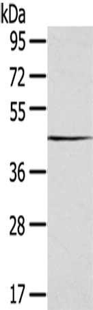 Gel: 8%SDS-PAGE,Lysate: 40 ug,,Primary antibody: CSB-PA158642(SEPT2 Antibody) at dilution 1/400 dilution,Secondary antibody: Goat anti rabbit IgG at 1/8000 dilution,Exposure time: 10S