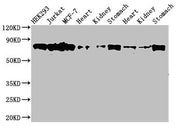 Western Blot Positive WB detected in: HEK293 whole cell lysate, Jurkat whole cell lysate, MCF-7 whole cell lysate, Rat heart tissue, Rat kideny tissue, Rat stomach tissue, Mouse heart tissue, Mouse kidney tissue, Mouse stomach tissue All lanes: PR...