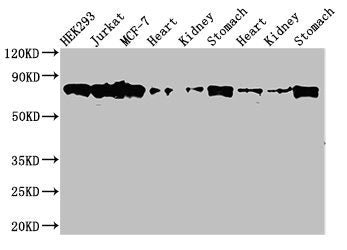 Western Blot Positive WB detected in: HEK293 whole cell lysate, Jurkat whole cell lysate, MCF-7 whole cell lysate, Rat heart tissue, Rat kideny tissue, Rat stomach tissue, Mouse heart tissue, Mouse kidney tissue, Mouse stomach tissue All lanes: PR...
