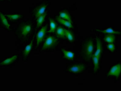 Immunofluorescence staining of Hela cells with CSB-PA15899A0Rb at 1:133, counter-stained with DAPI. The cells were fixed in 4% formaldehyde, permeabilized using 0.2% Triton X-100 and blocked in 10% normal Goat Serum. The cells were then incubated...