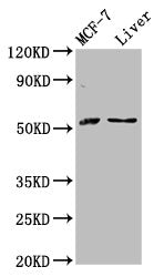 Western Blot Positive WB detected in: MCF-7 whole cell lysate, Rat liver tissue All lanes: AKT2 antibody at 2.8µg/ml Secondary Goat polyclonal to rabbit IgG at 1/50000 dilution Predicted band size: 56, 52 kDa Observed band size: 56 kDa