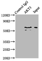 Immunoprecipitating AKT3 in mouse brain whole cell lysate Lane 1: Rabbit control IgG (1ug) instead of CSB-PA15929A0Rb in mouse brain whole cell lysate. For western blotting, a HRP-conjugated Protein G antibody was used as the secondary antibody (1...