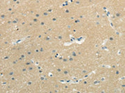 The image on the left is immunohistochemistry of paraffin-embedded Human brain tissue using CSB-PA159405(WASF3 Antibody) at dilution 1/25, on the right is treated with synthetic peptide. (Original magnification: ×200)