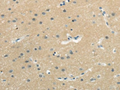 The image on the left is immunohistochemistry of paraffin-embedded Human brain tissue using CSB-PA159405(WASF3 Antibody) at dilution 1/25, on the right is treated with synthetic peptide. (Original magnification: ×200)