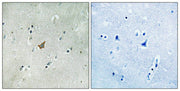 Immunohistochemical analysis of paraffin-embedded human brain tissue using EPHA3/4/5 (Phospho-Tyr779/833) antibody (left)or the same antibody preincubated with blocking peptide (right).