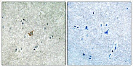Immunohistochemical analysis of paraffin-embedded human brain tissue using EPHA3/4/5 (Phospho-Tyr779/833) antibody (left)or the same antibody preincubated with blocking peptide (right).