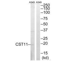 Western blot analysis of extracts from A549 cells, using CST11 antibody.