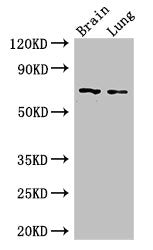 Western Blot Positive WB detected in: Mouse brain tissue, Mouse lung tissue All lanes: FOXO1 antibody at 2.5ug/ml Secondary Goat polyclonal to rabbit IgG at 1/50000 dilution Predicted band size: 70 kDa Observed band size: 70 kDa