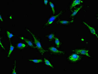 Immunofluorescent analysis of Hela cells using CSB-PA16069A0Rb at dilution of 1:100 and Alexa Fluor 488-congugated AffiniPure Goat Anti-Rabbit IgG(H+L)