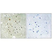 Immunohistochemistry analysis of paraffin-embedded human brain tissue using RPS19BP1 antibody.
