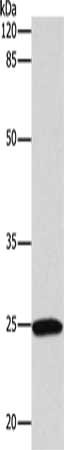 Gel: 10%SDS-PAGE, Lysate: 50 ug, Lane: Human urinary bladder tissue, Primary antibody: CSB-PA161481(RUNX1 Antibody) at dilution 1/450, Secondary antibody: Goat anti rabbit IgG at 1/8000 dilution, Exposure time: 1 minute