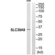 Western blot analysis of extracts from A549 cells, using SLC39A9 antibody.