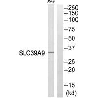 Western blot analysis of extracts from A549 cells, using SLC39A9 antibody.