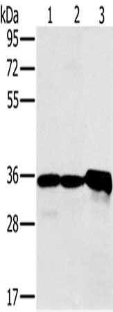Gel: 8%SDS-PAGE, Lysate: 40 ug, Lane 1-3: Mouse kidney tissue, Jurkat cells, mouse heart tissue, Primary antibody: CSB-PA162245(NDUFA9 Antibody) at dilution 1/400, Secondary antibody: Goat anti rabbit IgG at 1/8000 dilution, Exposure time: 1 minute