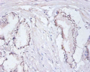 Immunohistochemistry of paraffin-embedded human prostate tissue using CSB-PA16239A0Rb at dilution of 1:100