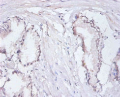 Immunohistochemistry of paraffin-embedded human prostate tissue using CSB-PA16239A0Rb at dilution of 1:100