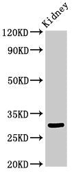 Western Blot Positive WB detected in: Rat kidney tissue All lanes: IGFBP7 antibody at 3.4ug/ml Secondary Goat polyclonal to rabbit IgG at 1/50000 dilution Predicted band size: 30, 29 kDa Observed band size: 30 kDa