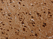 The image on the left is immunohistochemistry of paraffin-embedded Human brain tissue using CSB-PA163096(KARS Antibody) at dilution 1/60, on the right is treated with fusion protein. (Original magnification: ×200)