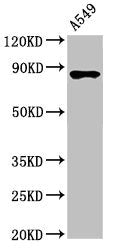 Western Blot Positive WB detected in: A549 whole cell lysate All lanes: IKBKB antibody at 3.4µg/ml Secondary Goat polyclonal to rabbit IgG at 1/50000 dilution Predicted band size: 87, 86, 30, 80 kDa Observed band size: 87 kDa