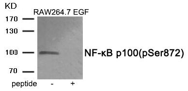 Western blot analysis of extracts from RAW264.7 cells treated with EGF using Phospho-NF-κB p100 (Ser872) antibody.The lane on the right is treated with the antigen-specific peptide.